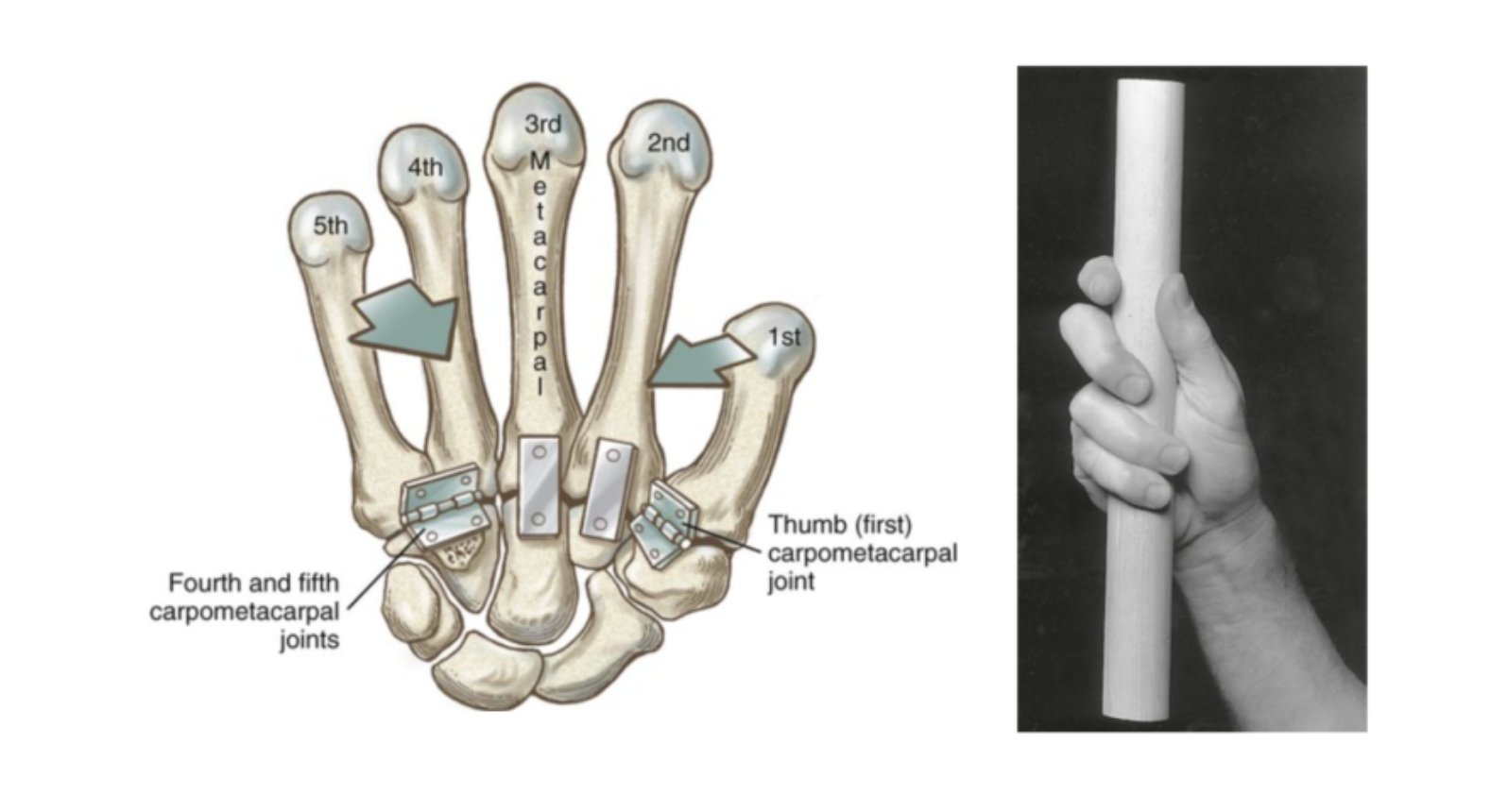 CMC 관절 해부학 도해와 원통형 그립